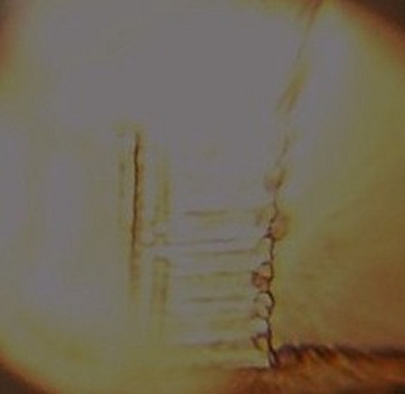Lp1-DDR.